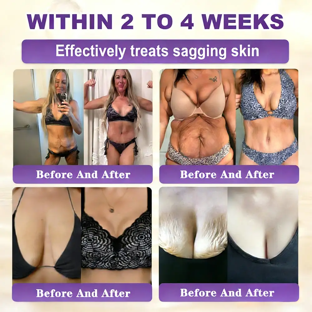 Biotin 10-in-1 Skin Restoration Cream - Image 9