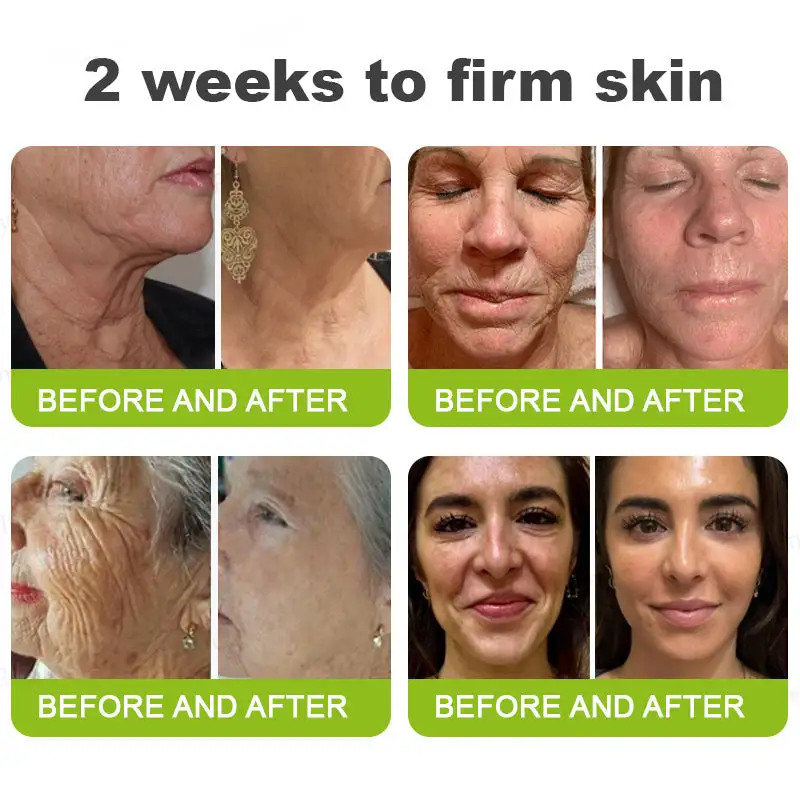 Botox Vita-A Retinol Shot Wrinkle-Lift Tightening cream - Last Day Promotion 70 OFF - Image 4