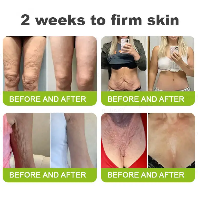 Botox Vita-A Retinol Shot Wrinkle-Lift Tightening cream - Last Day Promotion 70 OFF - Image 5