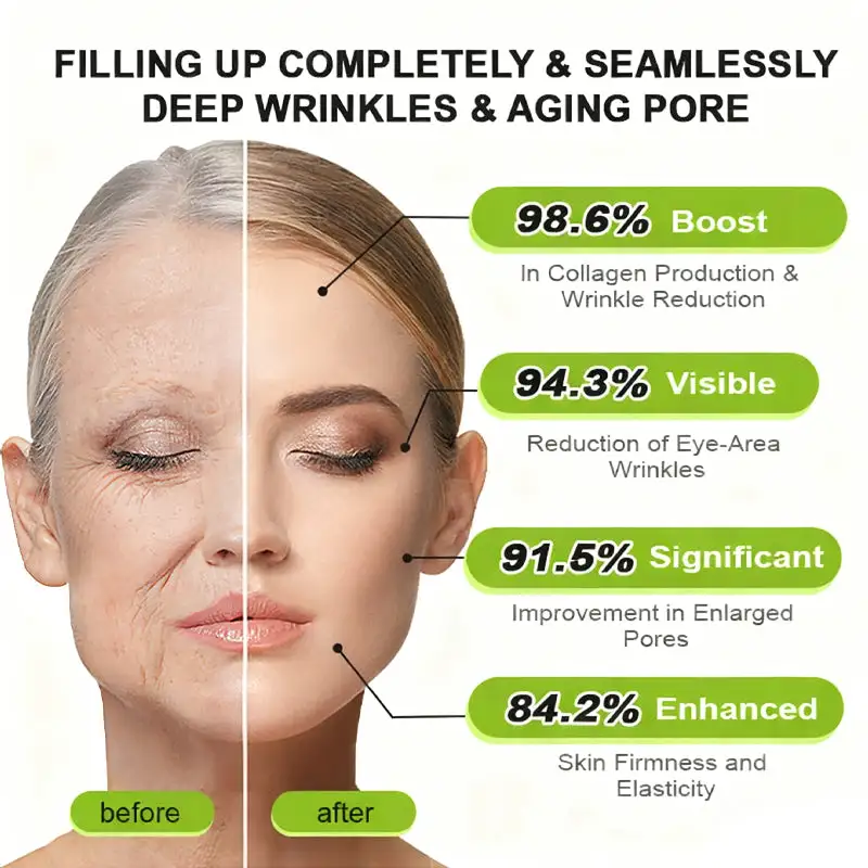 Botox Vita-A Retinol Shot Wrinkle-Lift Tightening cream - Last Day Promotion 70 OFF - Image 6
