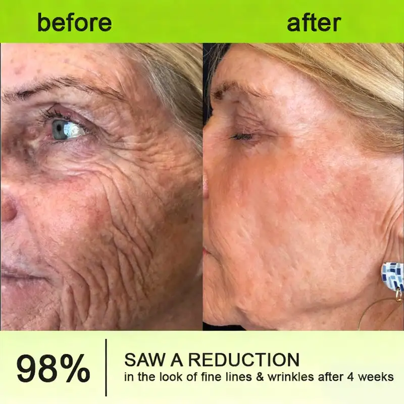 Botox Vita-A Retinol Shot Wrinkle-Lift Tightening cream - Last Day Promotion 70 OFF - Image 7