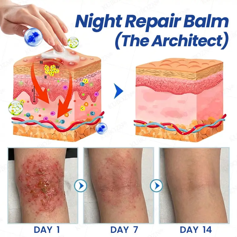Eczema Day & Night Repair System - 100% Steroid-Free Relief Duo for Intense Itch, Redness & Broken Skin - Image 3