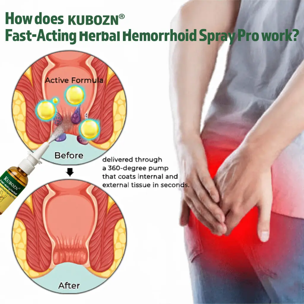 Fast-Acting Herbal Hemorrhoid Spray Pro Stops Bleeding Instantly Targets Internal/External Piles - Image 4