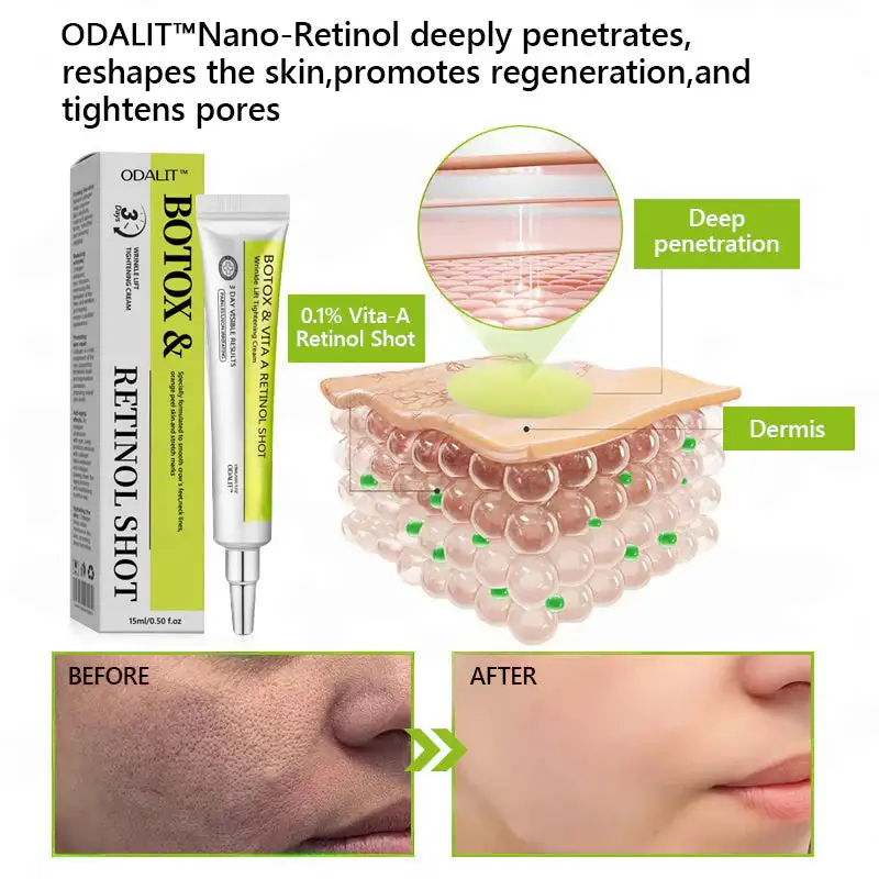 Botox & Retinol Shot - Eraser for Deep Wrinkles, Sagging Jowls & Puffy Eyes - Image 6