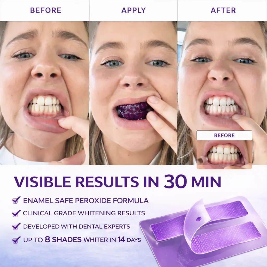 Novora Purple Teeth Whitening Strips - Image 6