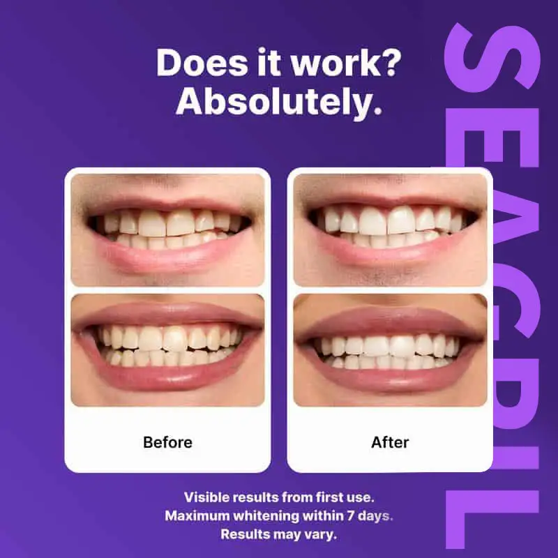 Purple Teeth Whitening Strips 7/21 Treatments Peroxide-Free Enamel Safe No Tooth Sensitivity - Image 5